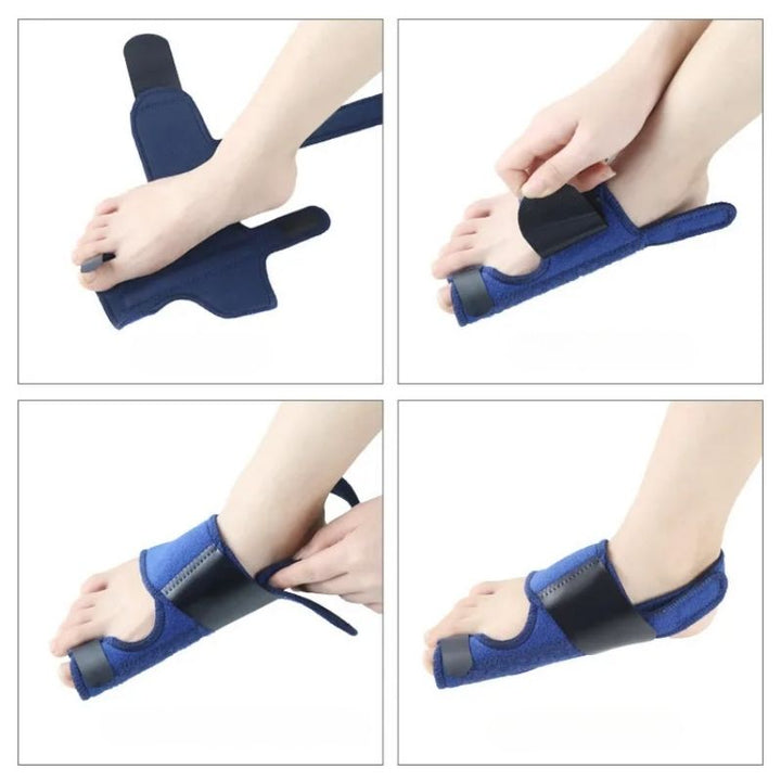 Fotsupport | Stödskena för Hallux Valgus med Justerbara Kardborrband | Optimal Stabilitet och Smärtlindring för Fötterna 3