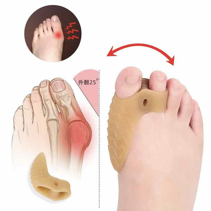 Hallux Valgus Skydd | Fotvård med Andningsbart Material | 2-Pack för Smärtlindring och Komfort 3