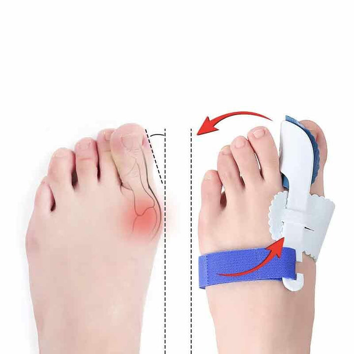 Stortå Separator för Hallux Valgus med Justerbar Passform | Effektiv Smärtlindring för Bekväm Tåposition 3